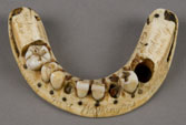 George Washington’s lower denture made of hippopotamus ivory