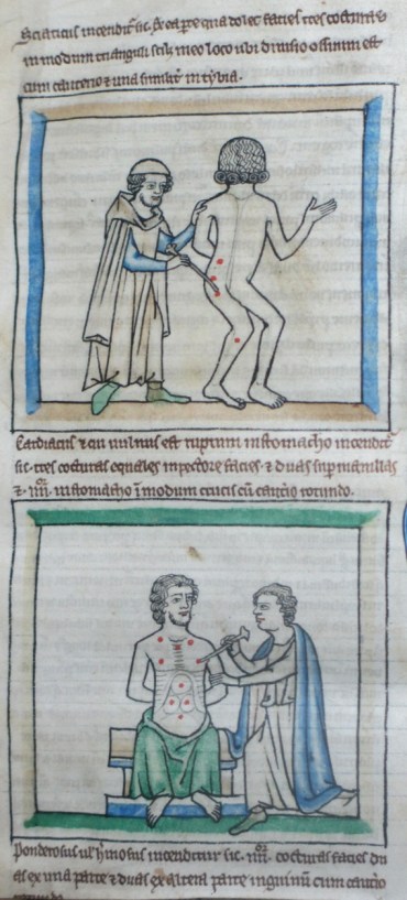 f. 3ra, cautery scenes