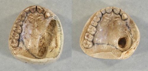 The 1893 (left) and 1897 (right) casts of President Cleveland's top teeth.