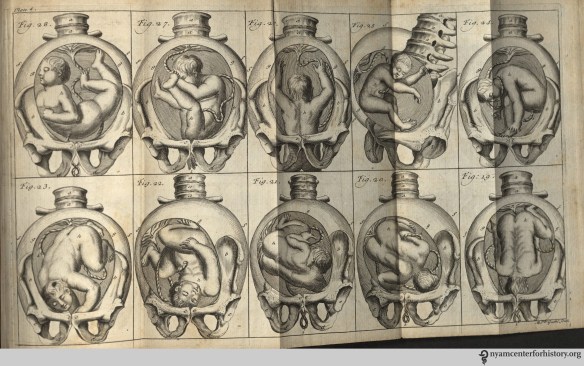 Plate 4, with figures showing shows the relation of a certain position of the fetus to the pelvis. Click to enlarge.
