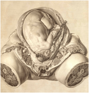 From Hunter’s Gravid Uterus. Image courtesy of the Dittrick Museum.