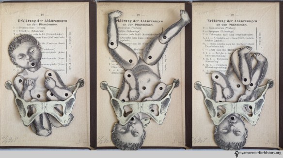 Moveable baby and female pelvis from one of NYAM’s 19th century obstetrics texts, Dr. K. Shibata's Geburtschülfliche Taschen-Phantom, or the Obstetrical Pocket-Phantom. 