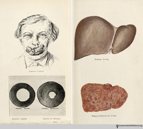 Kellogg, John Harvey. Tobaccoism or How Tobacco Kills. Battle Creek, MI: Modern Medicine Publishing; 1922.
