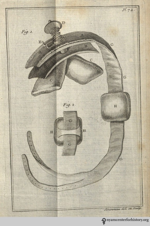 Petit's tourniquet. Plate 72 of Traité des maladies chirurgicales, et des opérations qui leur conviennent, 1774 edition.