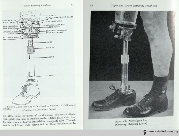 Adjustable above-knee leg. In William A. Tosberg,  Upper and Lower Limb Prostheses, 1962, p. 67-68.