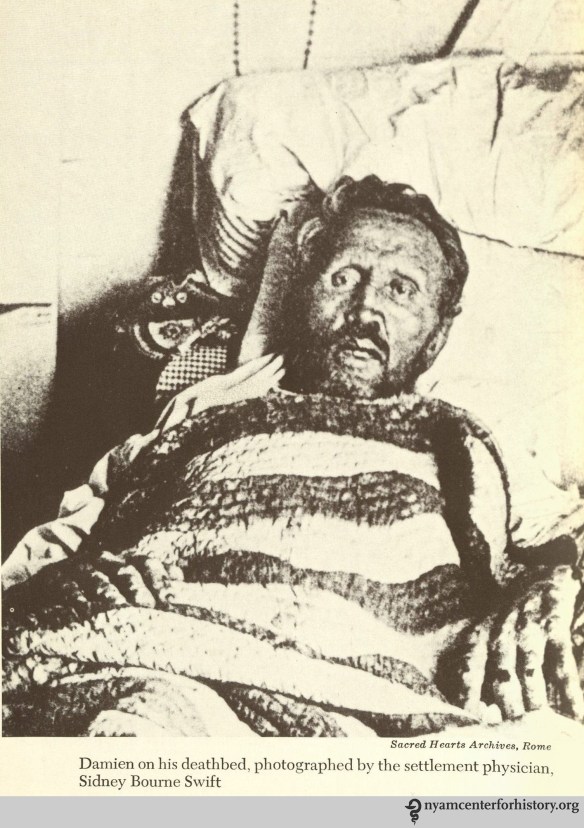 Damien on his deathbed, photographed by the settlement physician, Sidney Bourne Swift. In Daws, Holy man: Father Damien of Molokai, 1973.