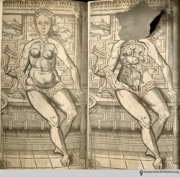 Female flap anatomy from The Academy's copy of the 1559 English edition of Geminus’ Compendiosa.