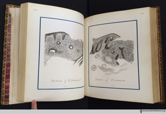 John Edwin Stillwell’s prize notebook of Dr. Fessenden Nott Otis’s lectures on venereal diseases, 1874–75.