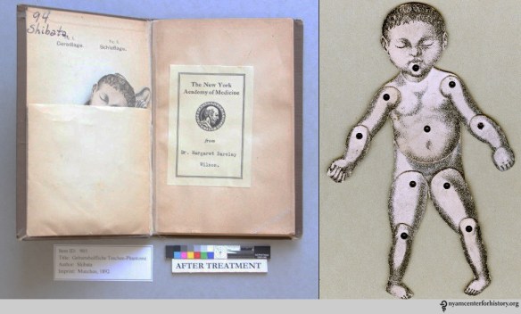 Koichi Shibata, Geburtshulfliche Taschen-Phantome, after treatment (left). The moveable paper baby (right). 