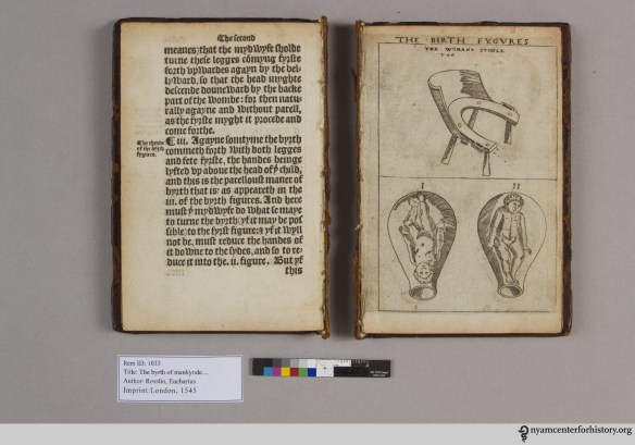 The byrth of mankynde, otherwise named The womans booke, before treatment.