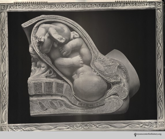 dickinson_birthatlas-page-001forfriendslecture_watermark