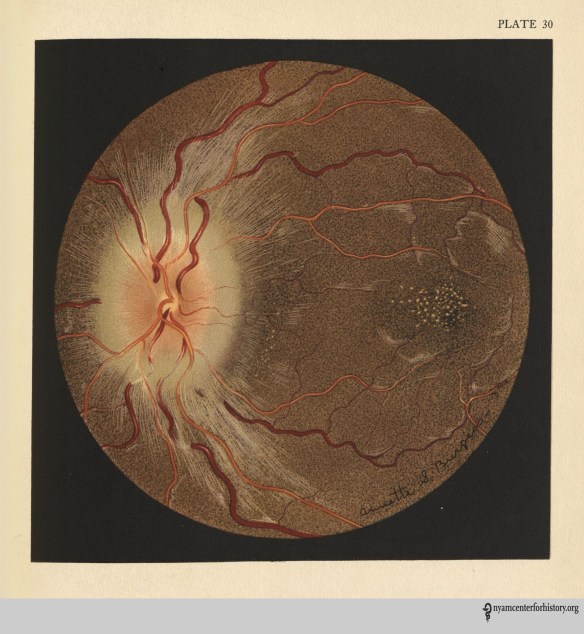 Burgess Pl. 30 Wilmer_watermark