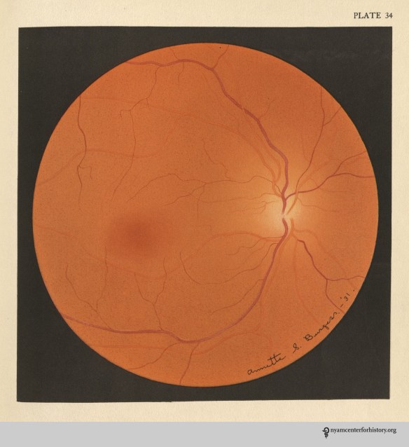 Burgess Pl. 34 Wilmer_watermark