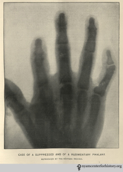 bostonmedsurgjournal_feb201896_rontgenprocess_watermark