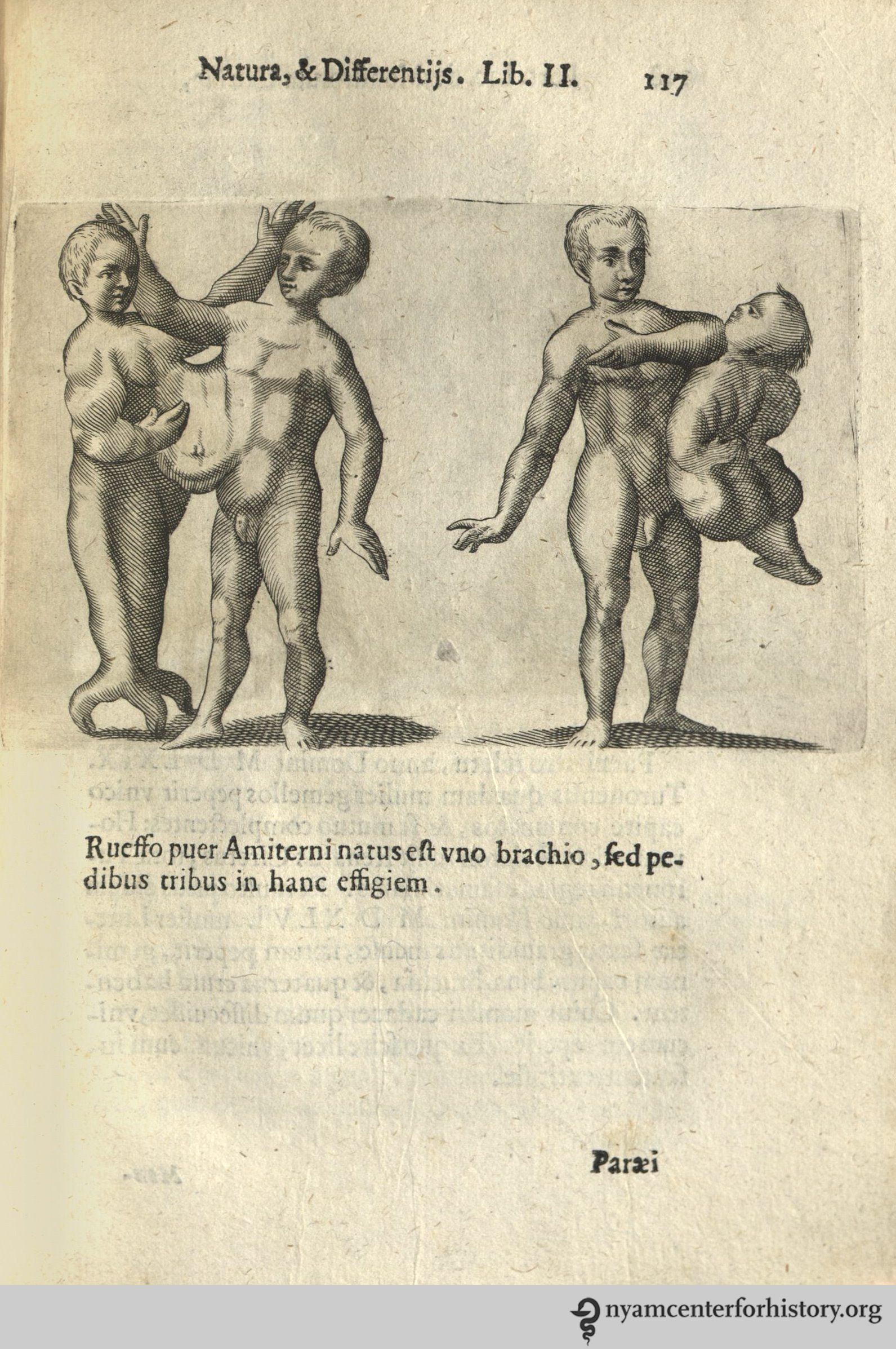 Liceti_DeMonstrorumCaussis_1634_117_watermark