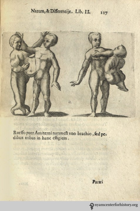 Liceti_DeMonstrorumCaussis_1634_117_watermark